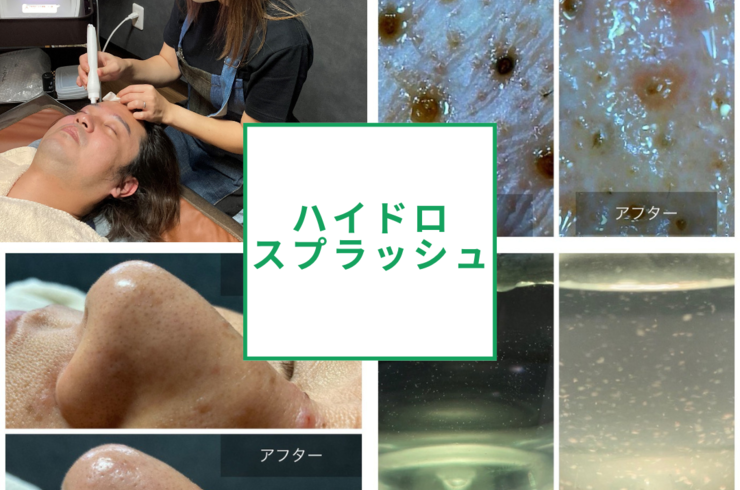 ハイドロスプラッシュ