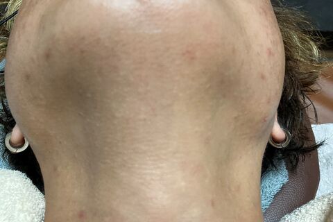 after