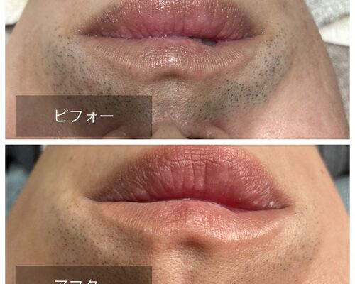 かずきビフォーアフター