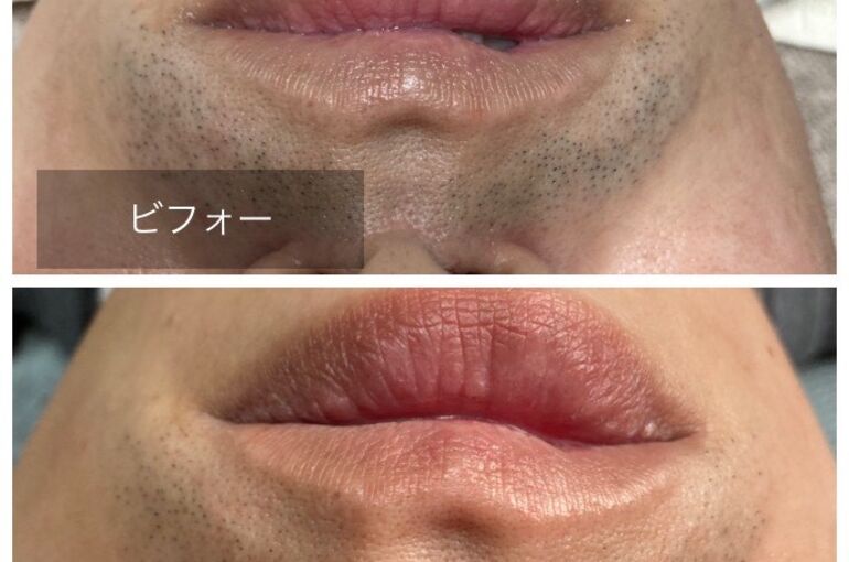 かずきビフォーアフター