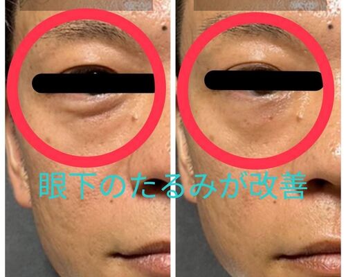 はぎコメント付