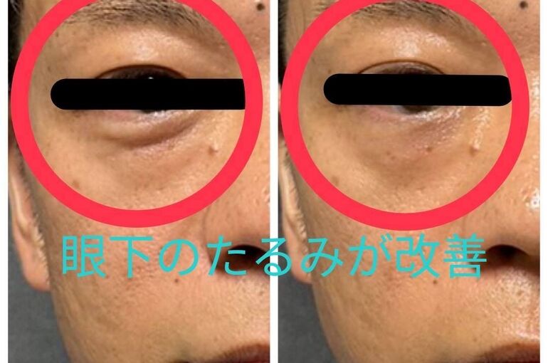 はぎコメント付