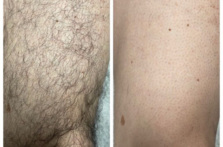 吉澤さんビフォアフ